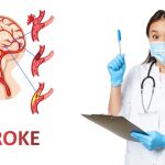 Kondisi Serius Stroke Pada Medis Harus Di Obati