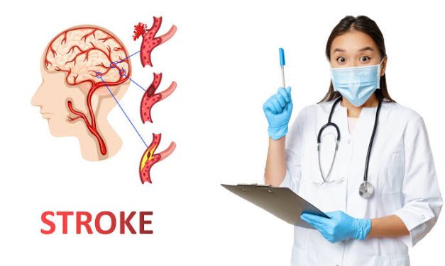Kondisi Serius Stroke Pada Medis Harus Di Obati